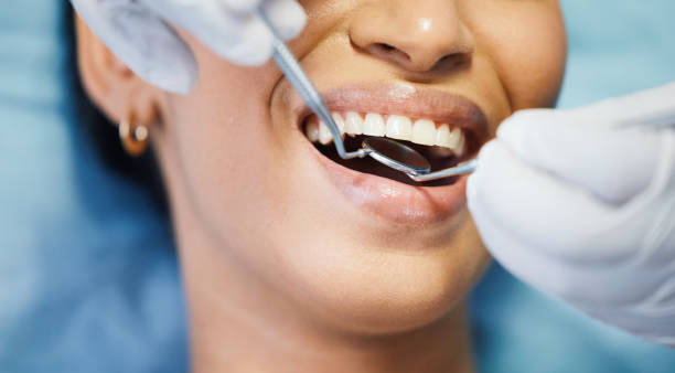 Best Emergency Dental Extractions in Metuchen, NJ